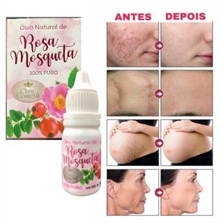 Óleo Massageador de Rosa Mosqueta Puro 10ml - clareador de manchas/rugas/estrias/hidratante/previne estrias na gravidez