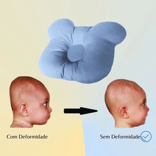 Travesseiro Plagiocefalia Cabeça Amassada Do Bebê em Oferta na Shopee