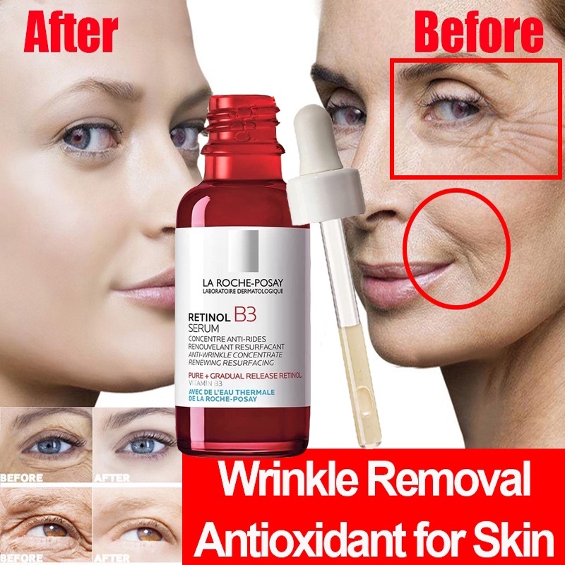 Soro Puro De Retinol Facial Com Vitamina B3 . Anti-Envelhecimento Para Linhas , Prematuro/Sol/Danos Ressurface & Hidrato Adequado Pele Sensível