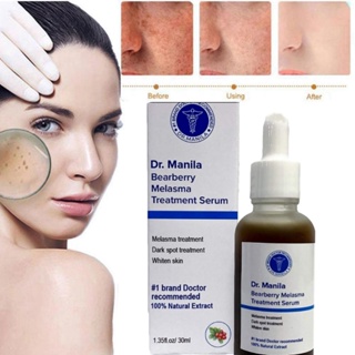 dr manila Tratamento De melasma De Bearberry Serum (No . 1 Para , Sardas) Removedor