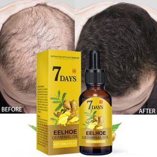 Produtos De Crescimento De Cabelo Gengibre Óleo Essencial Para Cabelos Rápido Natural Anti Queda Prevenir A Secagem Do Frizado Cuidados De Reparo Danificado