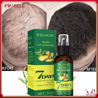 7 Eelhoe Days King Of Ginger Hair Growth Spray Hair Loss Prevention Promote Hair Growth Tough Hair Massage Scalp Dense hair Firming Body Care 50ml MAYBELE
