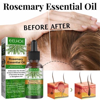Óleo Essencial Antiqueda De Alecrim Crescimento Rápido Anti Queda De Cabelo Reparação De Danos Calvície Couro Cabeludo Produto Cuidados Suaves