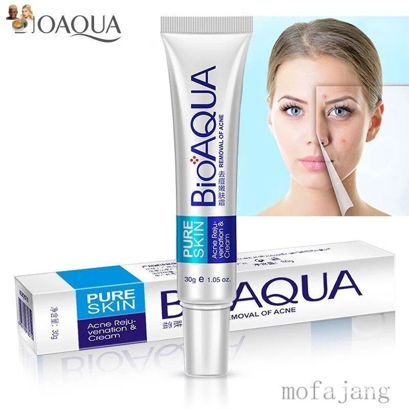 Bioaqua Creme Tratamento Para Remover Cravos/Cicatrizes/Remover Poros ...