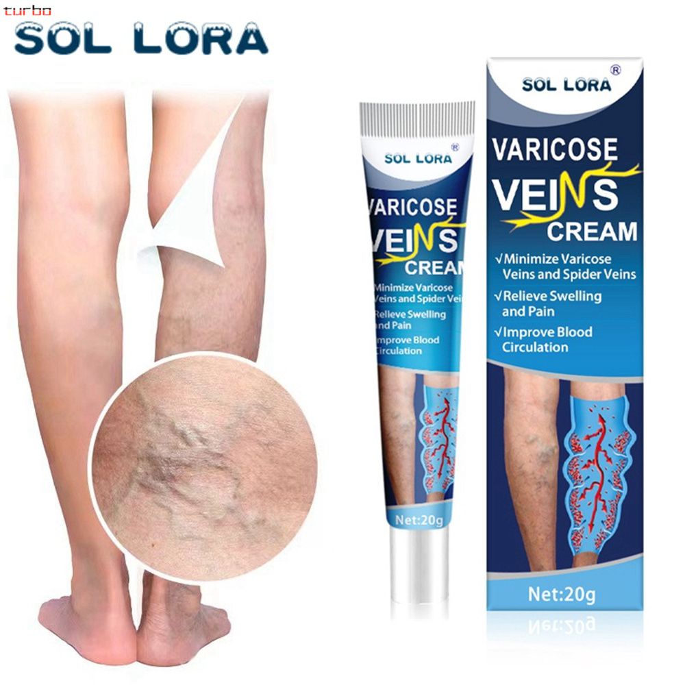 Creme de tratamento de veias nas pernas Circulação sanguínea Produtos ...