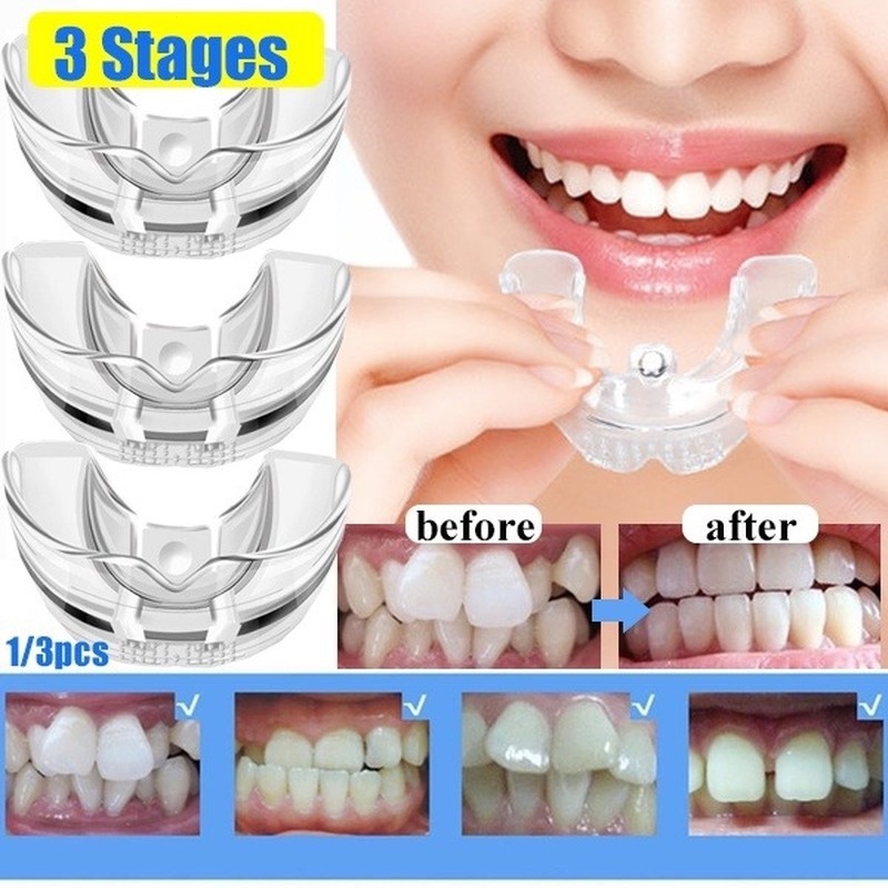 Corretor Dentário Ortodôntico Silicone Aparelhos Retentor Endireitar Ferramentas Dentárias Capadas Para Adultos De Cuidados Dentários 3 Fases XY