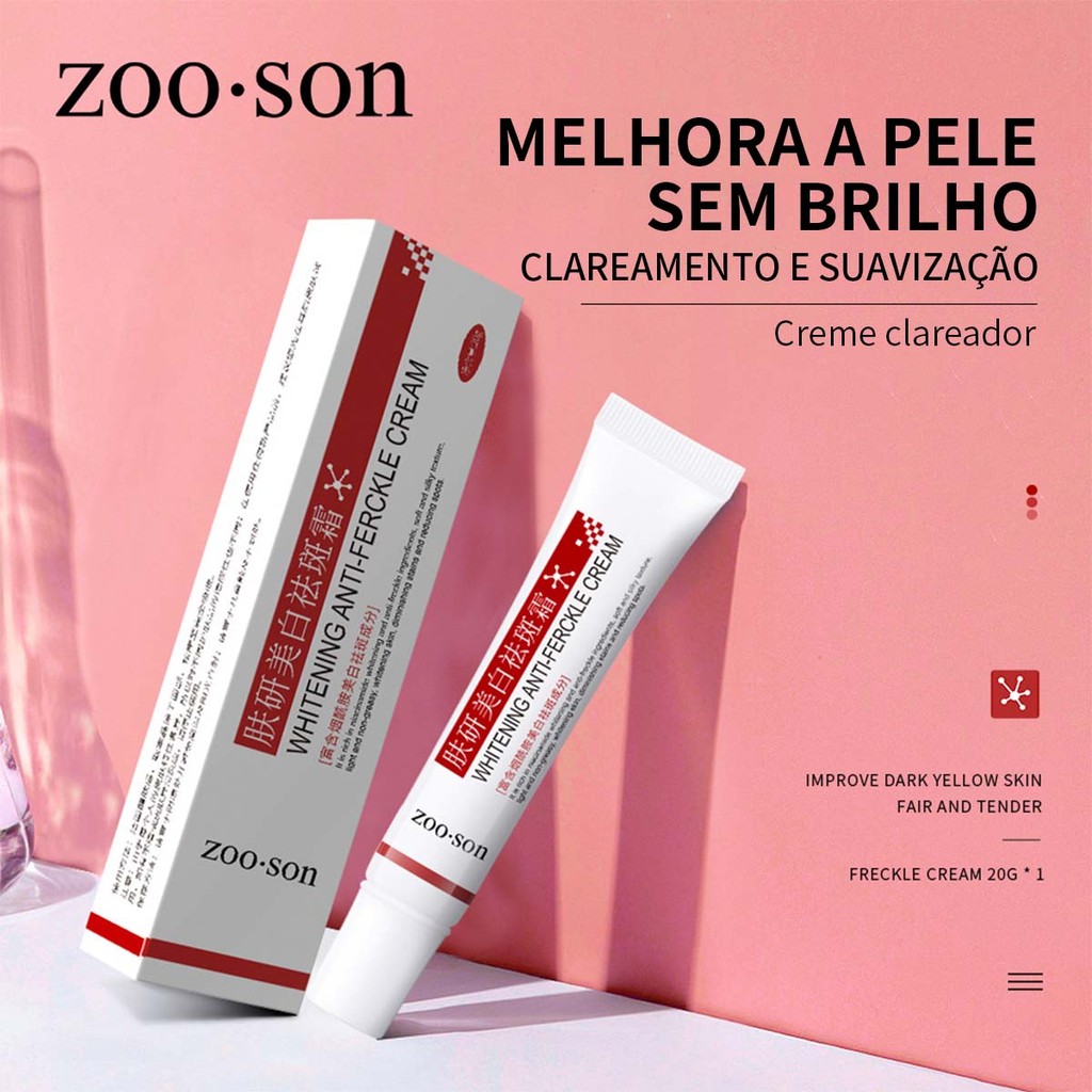 Creme Clareador Para Remover Melasma/Melã/Removedor De Pele Brilhante ...