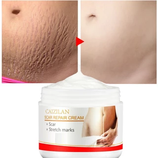 [MUSBAND] Cicatriz reparação creme pele remover estrias mulheres grávidas gravidez marca 30g OCYI cuidados em Oferta na Shopee