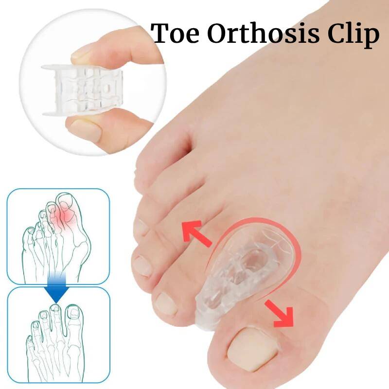 1 Par De Pés Grandes Separador De Ossos Do Dedo Pé Grande Órtese Clip Pad Hallux Valgus Silicone Sobreposto Bunion Corretor