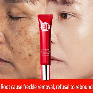 Creme forte original para remover manchas escuras/clareamento pigmentado/cuidados com a pele QRJZ MSKJ