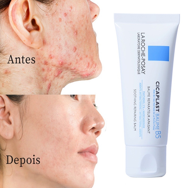 La Roche-Posay Cicaplast Baume B5 Irritação multiuso da pele seca 40 ml ...