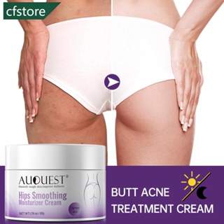 CFSTORE Butt Creme Branqueador De Nádegas De Pêssego Clareador Tratamento Acne Spot Brighten Skin Care B7V8