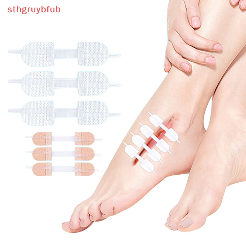 STHB Zipper Tie Wound Closure Patch Hemostático Faixa De Sutura Rápida ...