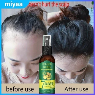 Eelhoe spray de crescimento capilar, soro capilar, óleo de essência de gengibre, promove o crescimento do cabelo, ingredientes naturais de gengibre, cultivador de cabelo miyaa.br