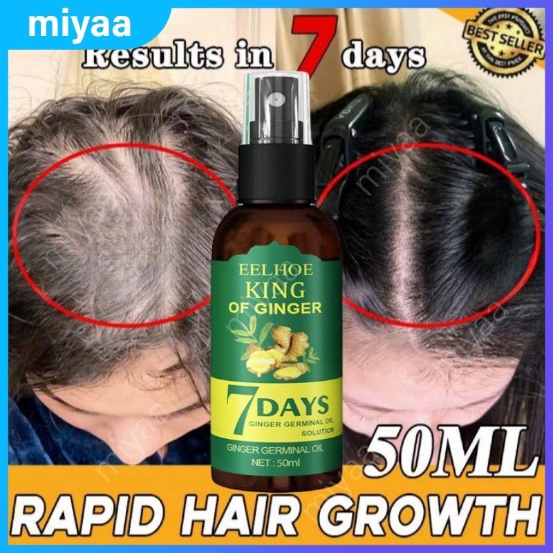 50ml gengibre spray de crescimento do cabelo soro anti perda de cabelo rápido crescimento líquido germinativo ingredientes naturais orgânicos recrescimento do cabelo miyaa.br