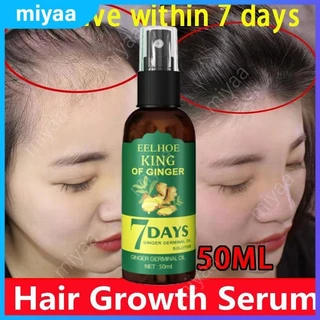 50ml spray de crescimento do cabelo gengibre rápido crescimento do cabelo essência anti perda de cabelo eficaz ingredientes naturais de gengibre soro de cuidados com o cabelo miyaa.br