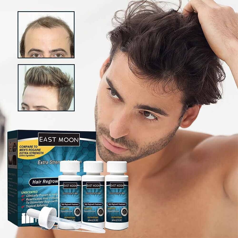 1/3PCS Extra Strength Topical Solution Tratamento De Crescimento De Cabelo Para Homens Aplicador De Queda Incluído