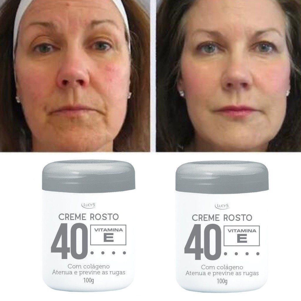 Kit 2un Cremes Anti Rugas Com Colágeno Sinais Profundos 40+ Anos 100gr ...