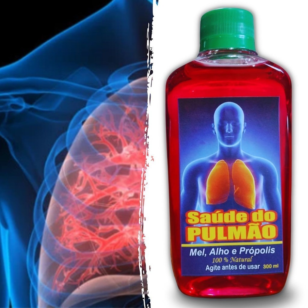 Kit 2 Un Xarope Saúde do Pulmão 300ml - Mel Alho e Própolis | Shopee Brasil