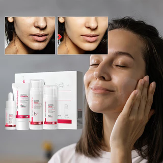 LAIKOU Pro 5 % Niacinamida Cuidados Com A Pele 4pcs/Set Creme Antienvelhecimento Toner Brilhante Facial