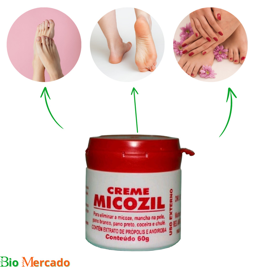 KIT 06 Pomada Creme Micozil 50g - Combate Micoses | Shopee Brasil