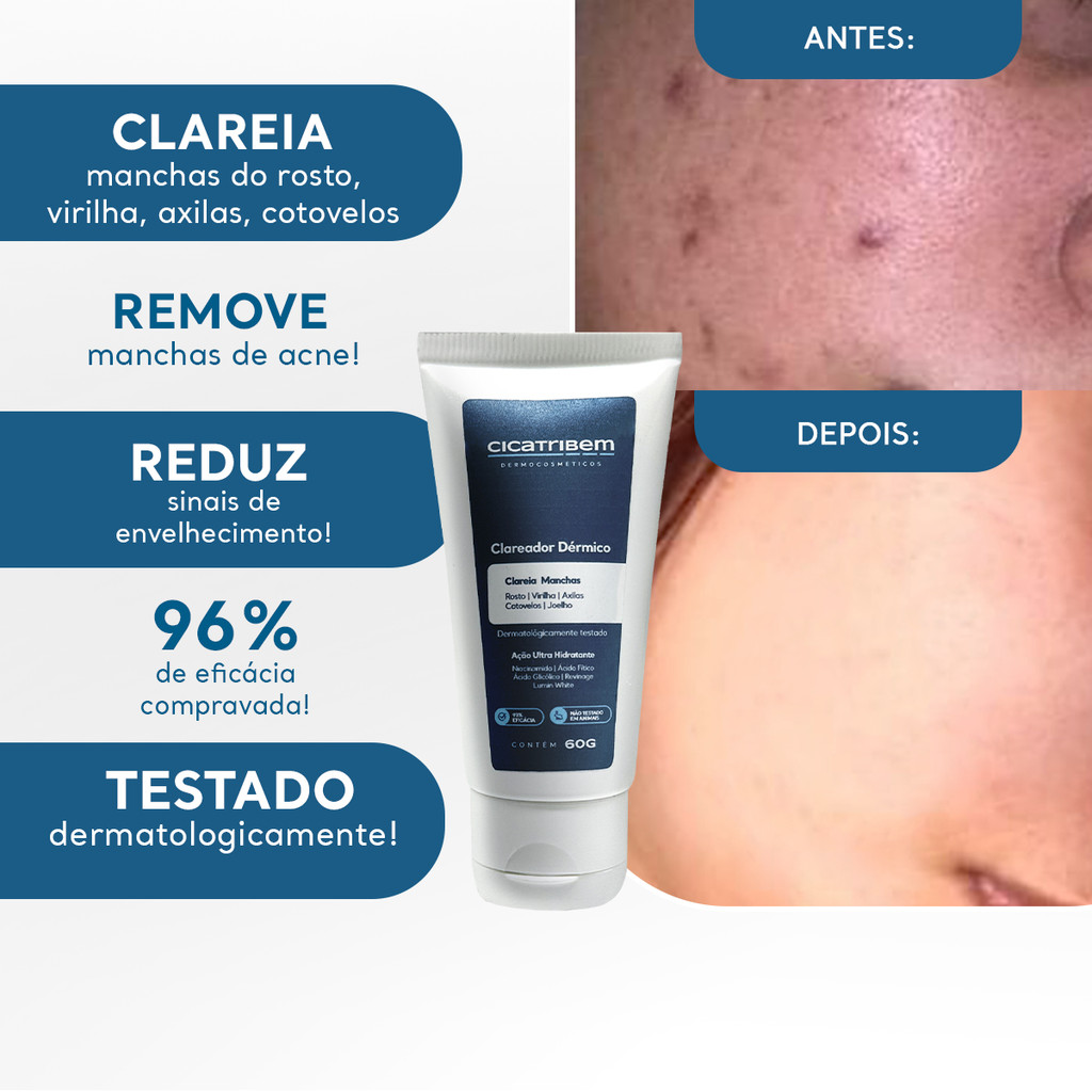 Clareador de Cicatriz: Onde Comprar | BuscaProdutos