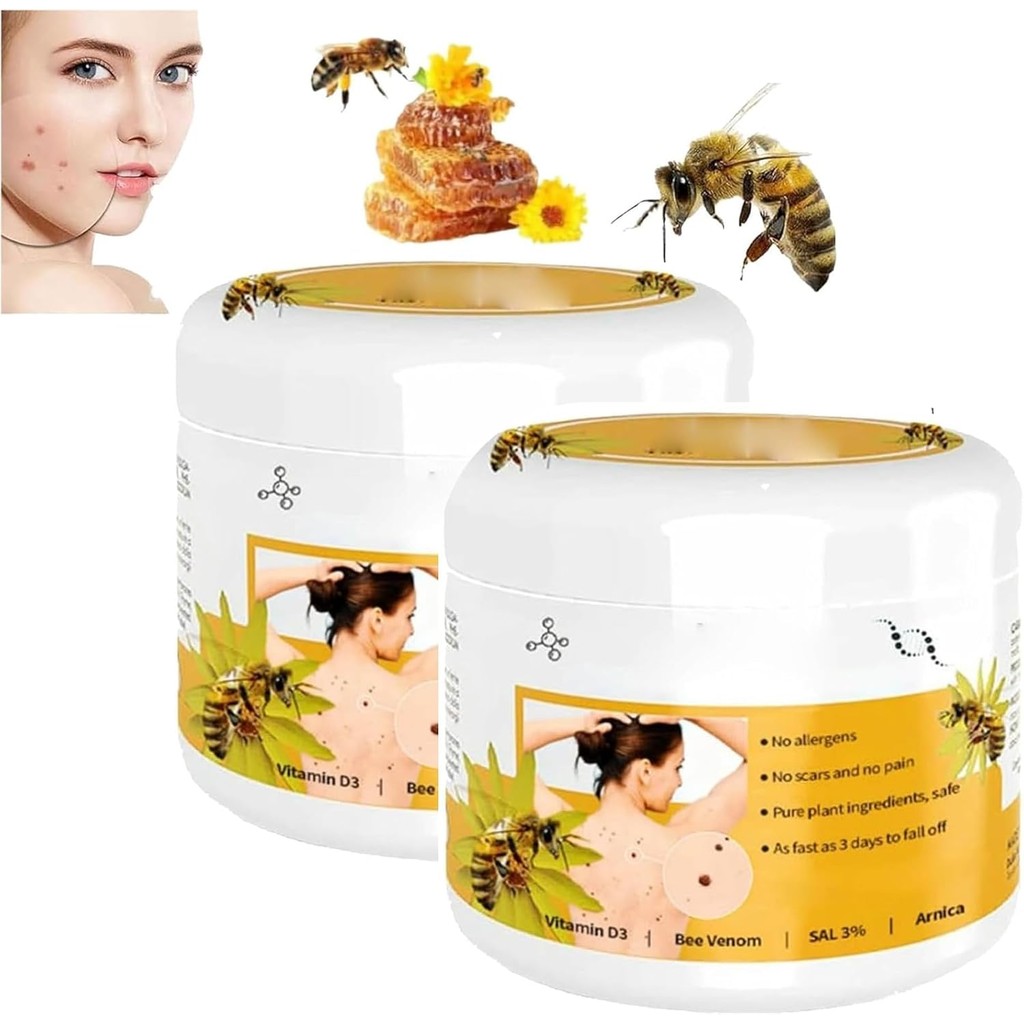 Crème Anti-verrues 7 Days - 50g, Ingrédients Naturels - Expiration Avril 2027 - Envoi Discret