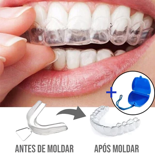 Bracket Ortodontico Transparente: Onde Comprar | BuscaProdutos