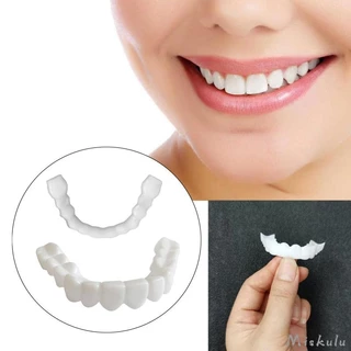 [Facetas Falsas De Dente Cobertura Sorridente Inferior Superior