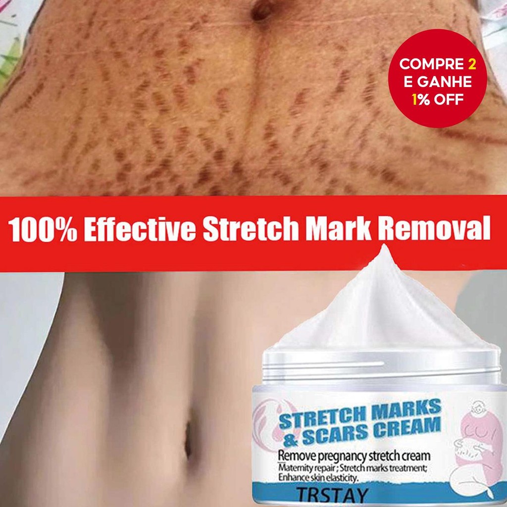 Creme Reparador De Estrias Para Gravidez TRSTAY-, Hidratantes E Cremes ...