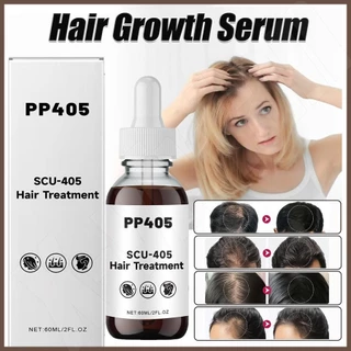 PP405 Tratamento Capilar Crescimento Anti-Perda De Cabelo Absorve Rapidamente Óleo De Não Oleoso nuaedatvn