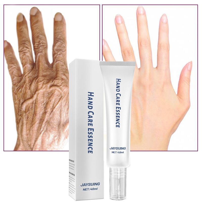  cido Hialur nico Remover Rugas Creme Hidratante Para As M os Gel