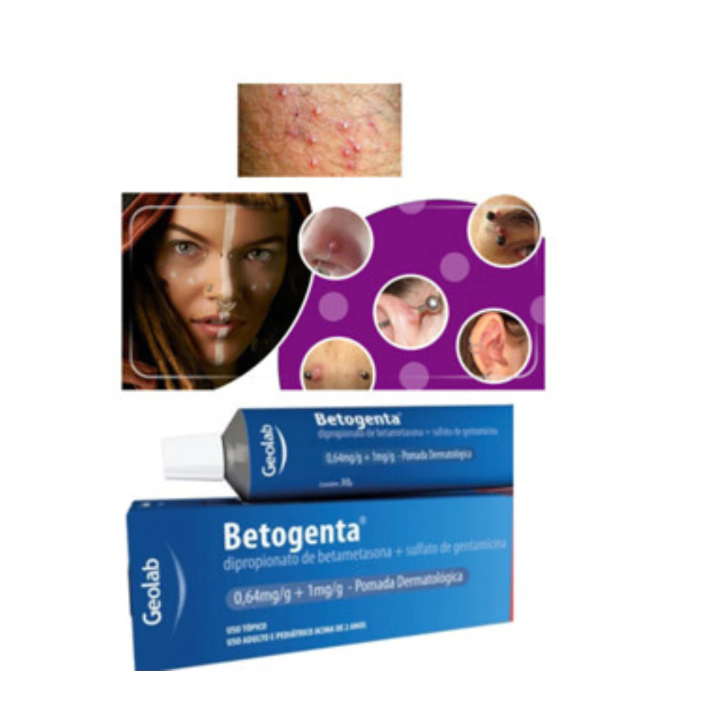 Betogent Pomada Para queloide de piercing | Shopee Brasil