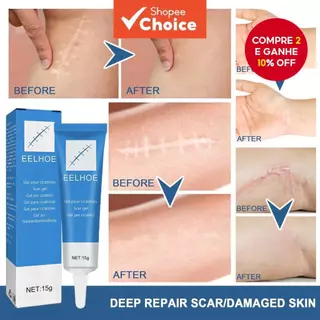 Gel De Recuperação De Aparência De Pele-Para Cuidados Com Cicatrizes E Marcas , Pós-Cirurgia Fórmula De Suporte Facial em Oferta na Shopee