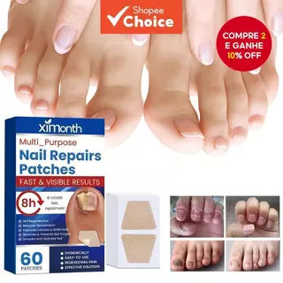 60 Pçs Adesivos De Correção Encravada De Unhas Respirável Remendos De Reparo Recuperar Pegajoso Para Descoloridas Ou Dan em Oferta na Shopee