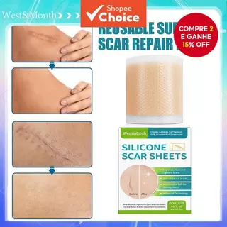 Adesivo De Cicatriz De Silicone West & Mês 4 * 150 Cm Desbota Todos Os Tipos De Cicatrizes Beleza Suave Para Cuidados Co em Oferta na Shopee