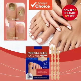 NOVO 21Pçs Adesivo para Fungo de Unha Impermeável Reparador de Unha Adesivo de Correção para Unha Encravada Unha em Oferta na Shopee