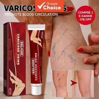 20g De Creme Calmante Para Veias Varicosas | Extrato De Gerânio , Trevo E Erva-Mãe Fortalece As , Textura Leve em Oferta na Shopee