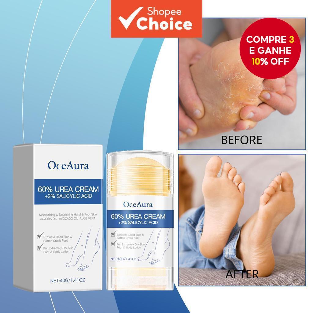 Creme Hidratante Para Pés 40g – Bálsamo Reparador De Calcanhar Rachado ...