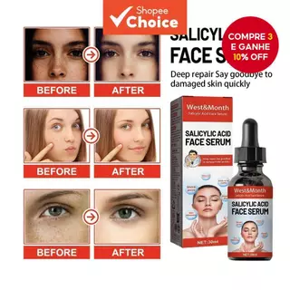 Soro De Ácido Salicílico 30ml Reafirmante , Lifting , Iluminador , Redutor De Poros , Hidratante , Niacinamida , Produto em Oferta na Shopee