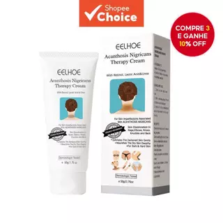 Creme para a Acantose Nigricante: Remoção de Manchas Escuras nos Cotovelos Joelhos Tornozelos Cantinhos das Axilas e em Oferta na Shopee