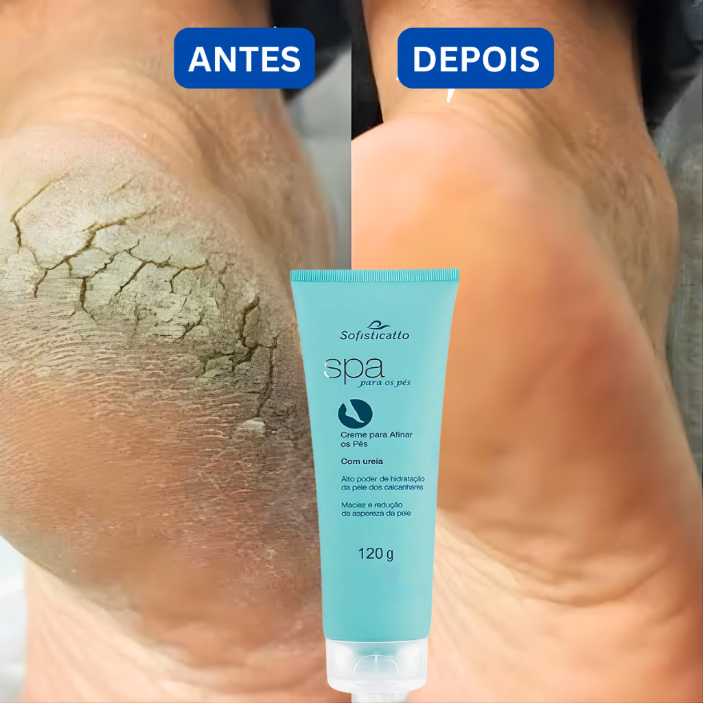 Creme spa dos pés de Pedreiro para pe rachado pele ressecada Cotovelo ...