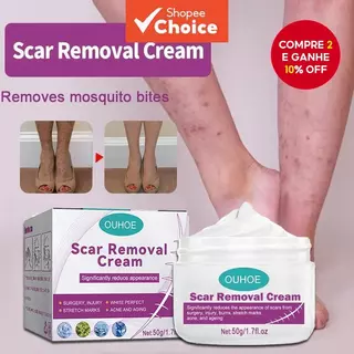 Creme De Remoção De Cicatriz Pé Reparação Cicatrizes Antigas em Oferta na Shopee
