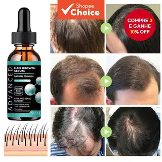 Óleo De Crescimento De Barba Masculino-Fórmula Rápida De Espessamento De Cabelo Para Mais Completa E Cuidados Nutritivos em Oferta na Shopee