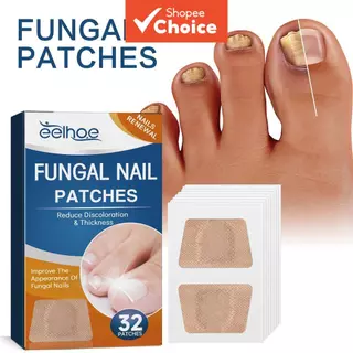 32 peças adesivo de correção de unhas dos pés para fungo cinza, unhas grossas, unhas encravadas e infecções parônicas em Oferta na Shopee