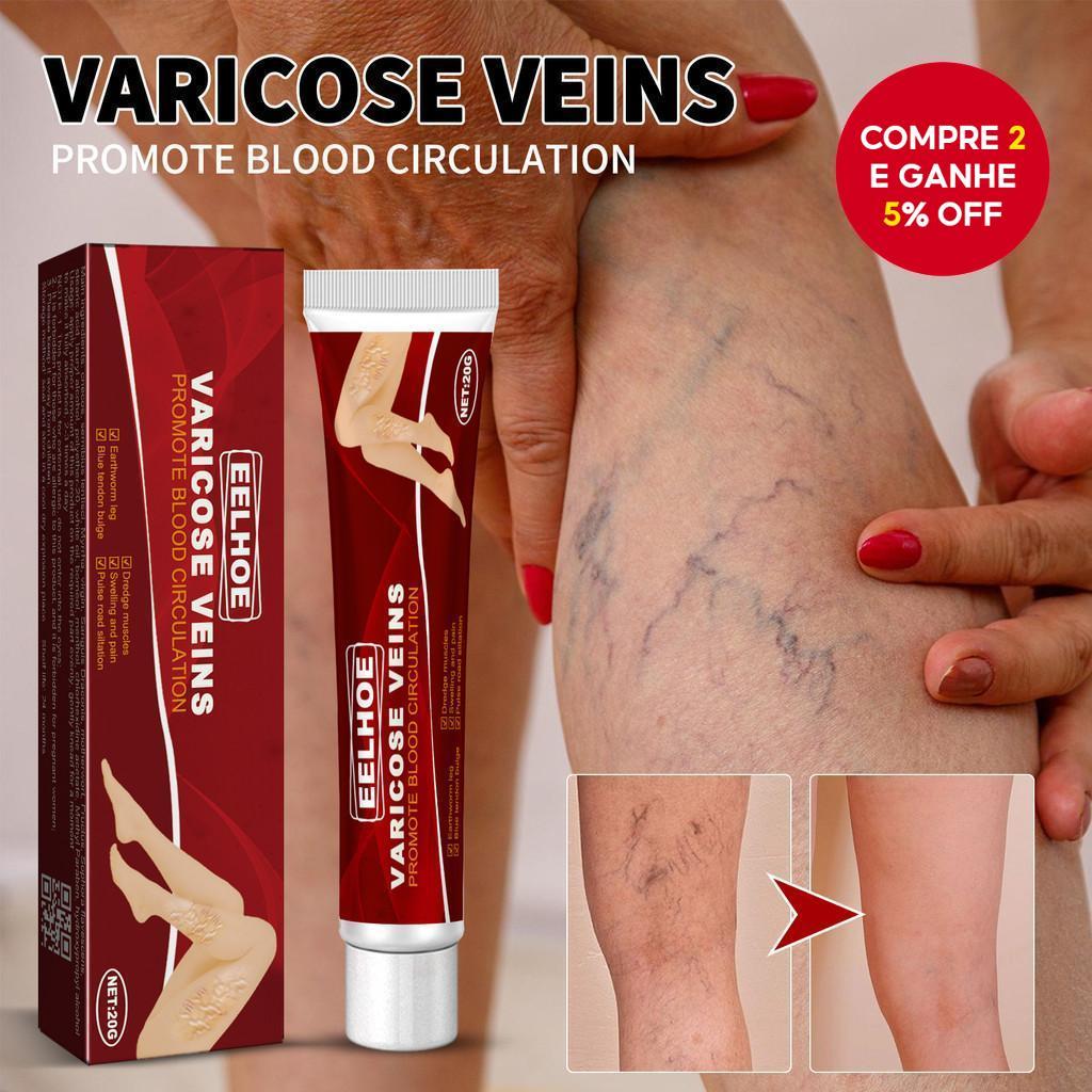 Creme para Veias Varicosas de 20g com Gerânio, Lentilha e Erva-de