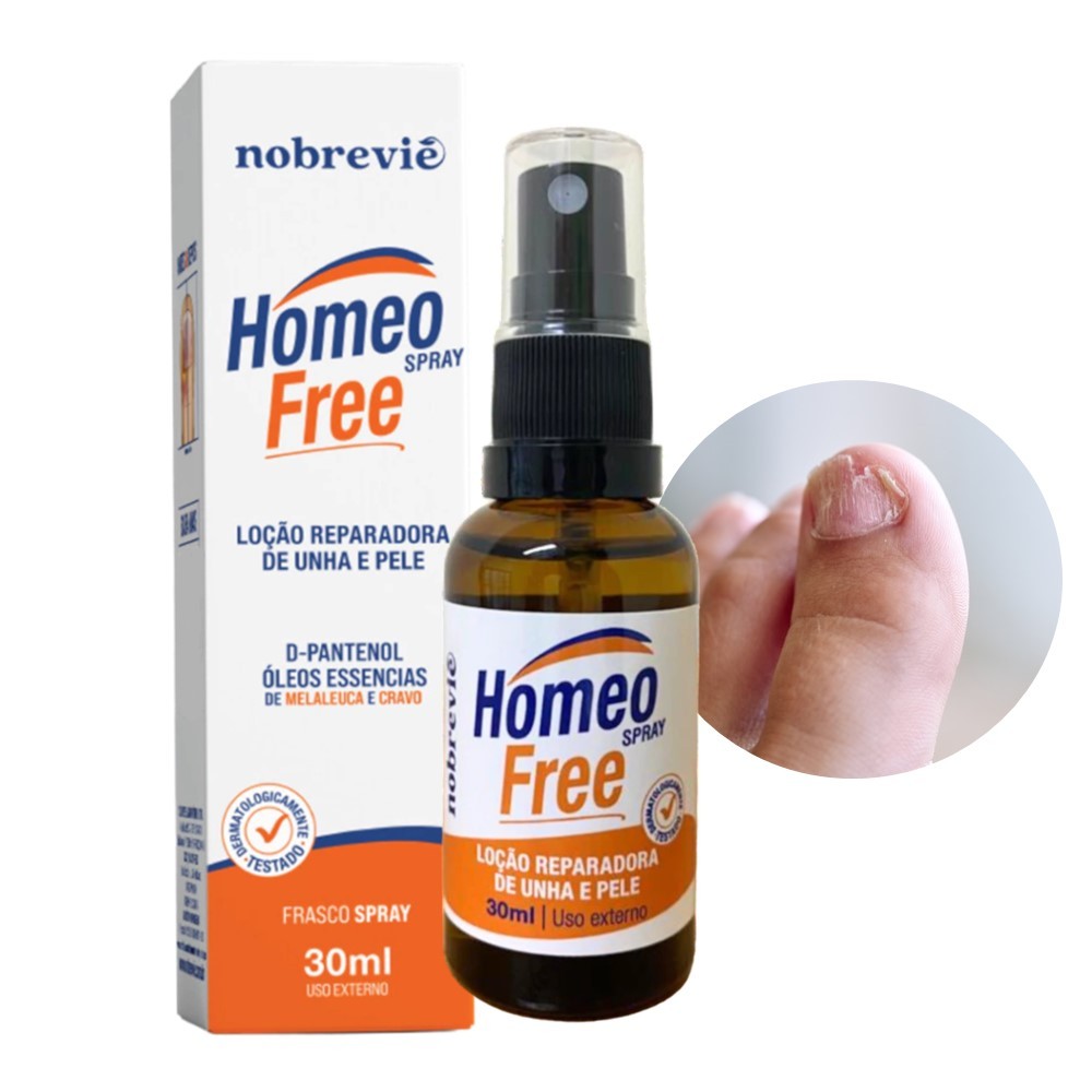 Loção Reparadora de Unha e Pele Tratamento de Micose HomeoFree Spray ...