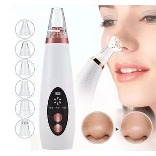Limpador Elétrico Removedor De Cravos E Poros Elétrico Recarregável Usb Com 6 Pontas De Limpeza