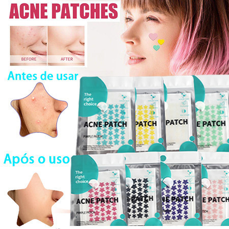 Adesivo para Espinha Forma de Estrela Hidrocoloide - 40/80/120 Unidades ...
