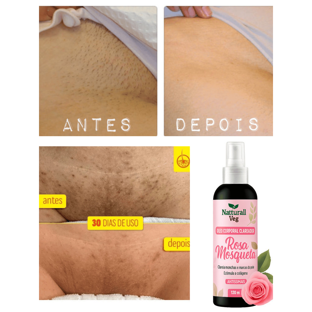 Clareador Clareia Manchas e Marcas da Pele Antissinais Óleo De Rosa ...